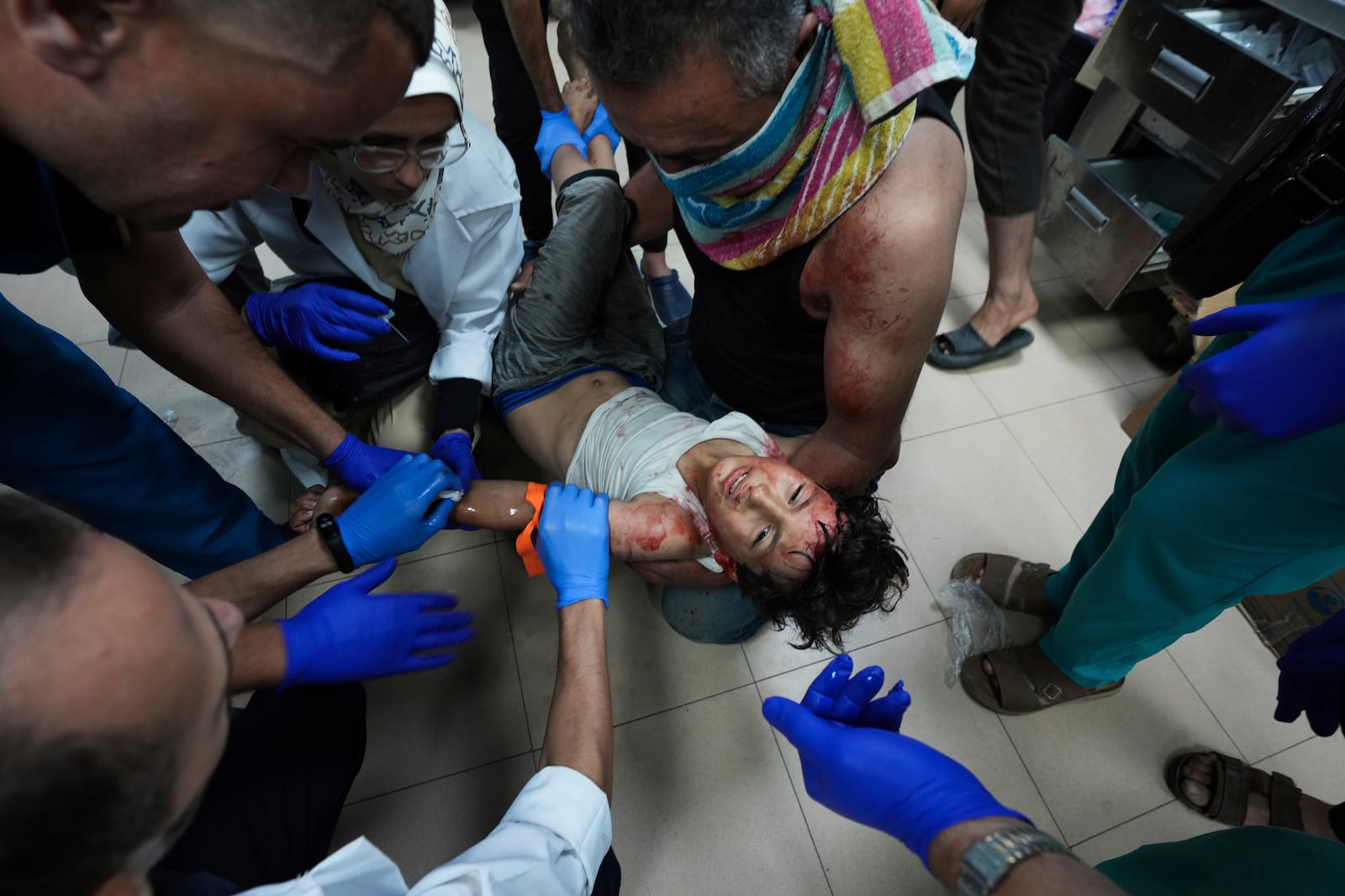 A Palestinian child wounded in the Israeli bombardment of the Gaza Strip is treated in a hospital in Deir al-Balah, Monday, Sept. 23, 2024. (AP Photo/Abdel Kareem Hana)