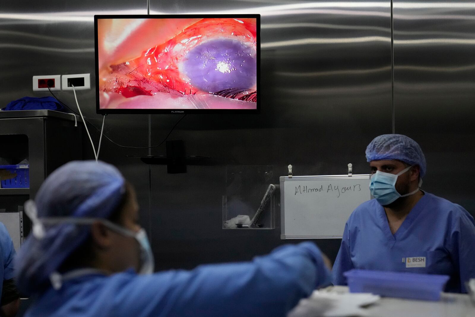 A damaged eye of a man who was injured in one of the handheld exploding devices is seen through a screen, inside an operation room during an eye surgery at the Eye Specialist hospital, in Beirut, Lebanon, Friday, Sept. 20, 2024. (AP Photo/Hussein Malla)