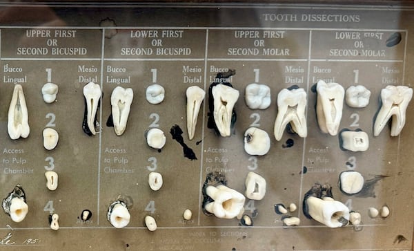 Dissected human teeth are displayed in the office of dentist Dr. James Bekker, April 30, 2025, in Salt Lake City, Utah. (AP Photo/Hannah Schoenbaum)