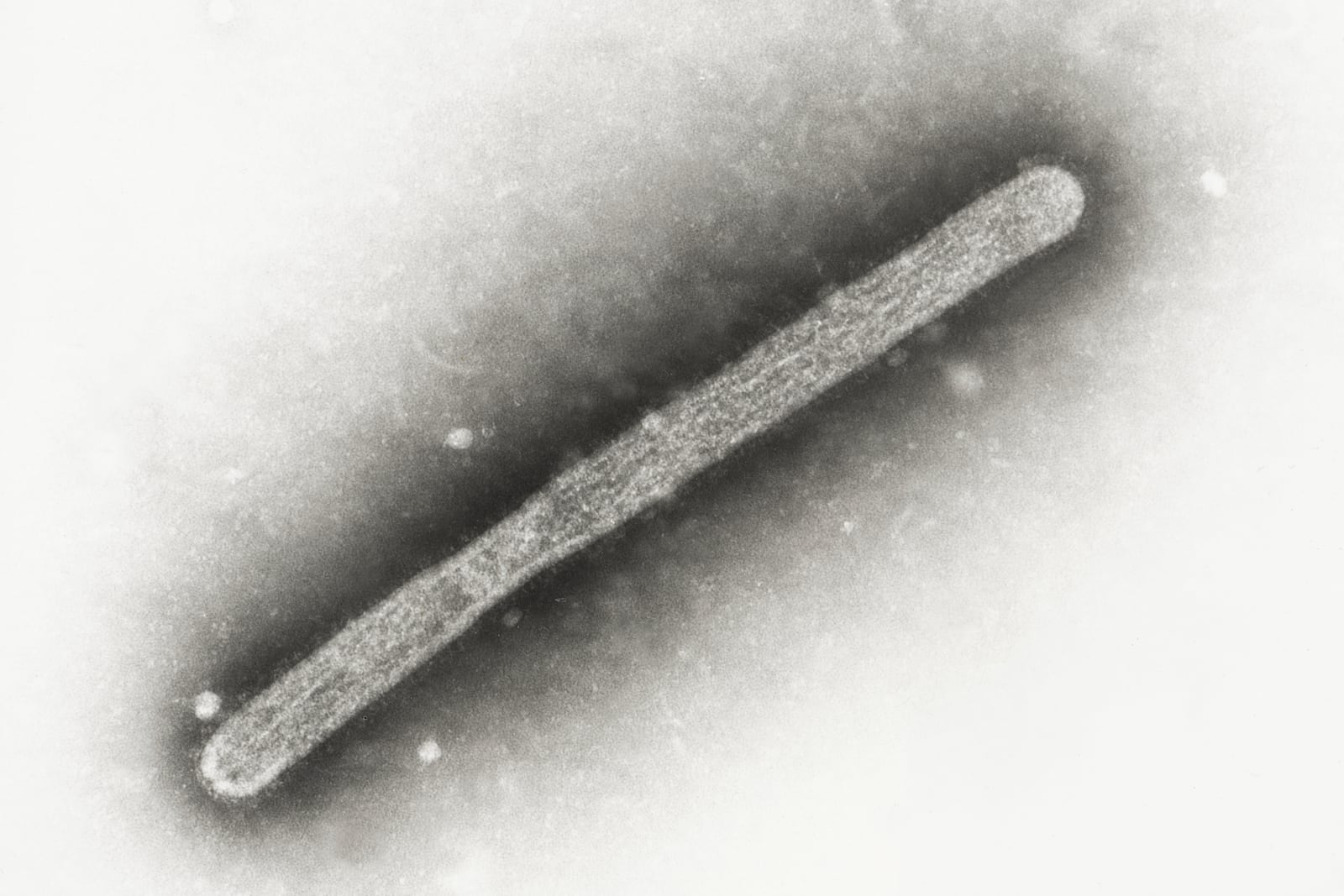 FILE - This 2005 electron microscope image shows an avian influenza A H5N1 virion. (Cynthia Goldsmith, Jackie Katz/CDC via AP, File)