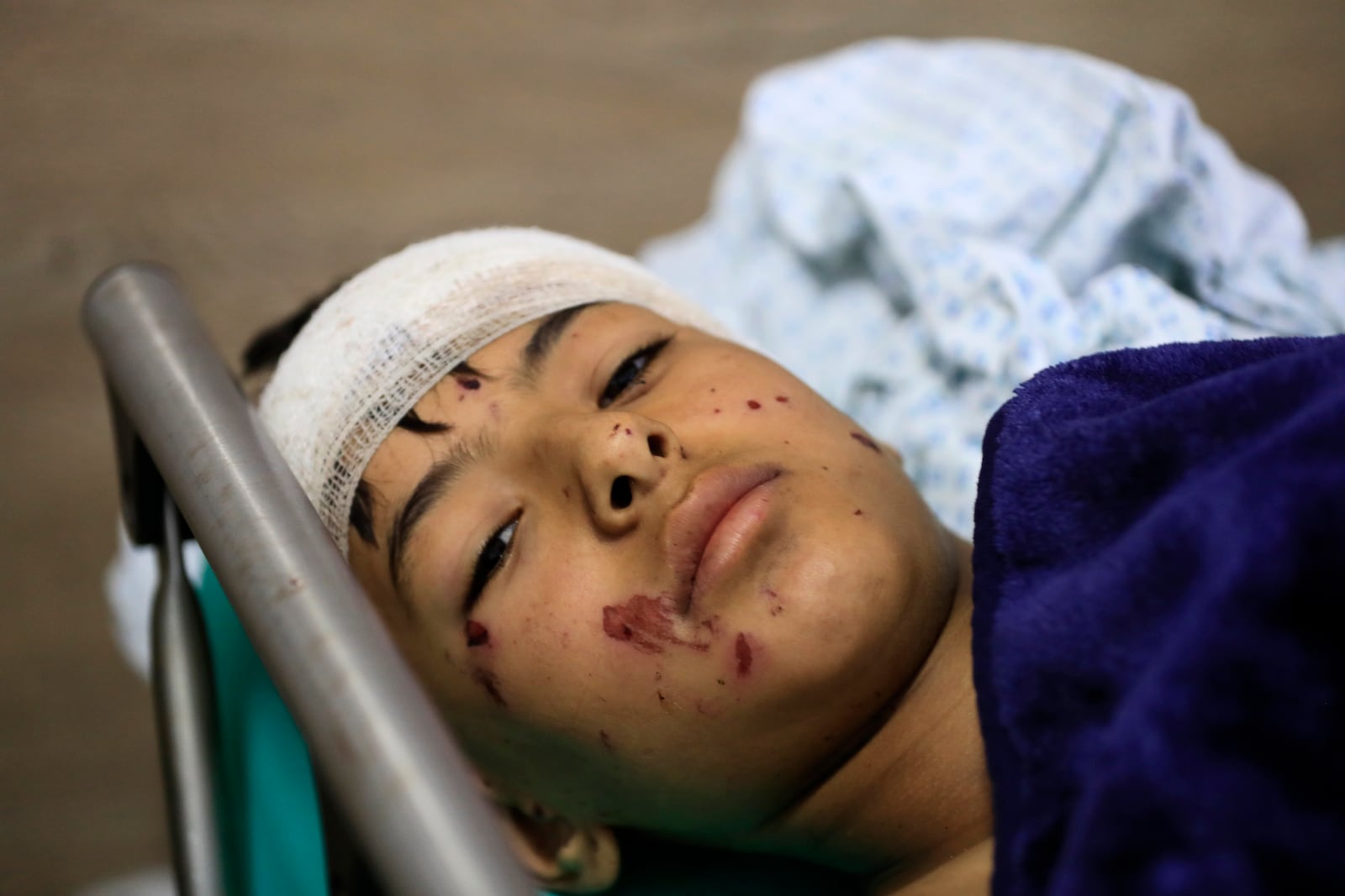 A wounded boy lies in a hospital bed in the southern village of Saksakieh, Lebanon, Tuesday, Sept. 24, 2024. (AP Photo/Mohammed Zaatari)