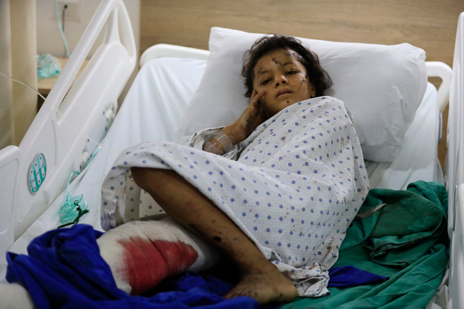 A wounded girl lies in a hospital bed in the southern village of Saksakieh, Lebanon, Tuesday, Sept. 24, 2024. (AP Photo/Mohammed Zaatari)